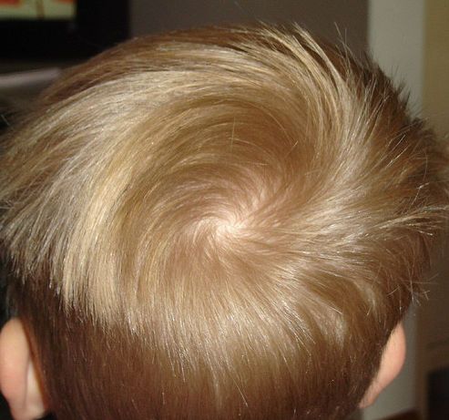 What is a hair cowlick?