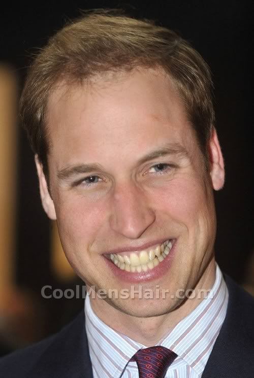 prince william hair loss treatment. Photo of Prince William